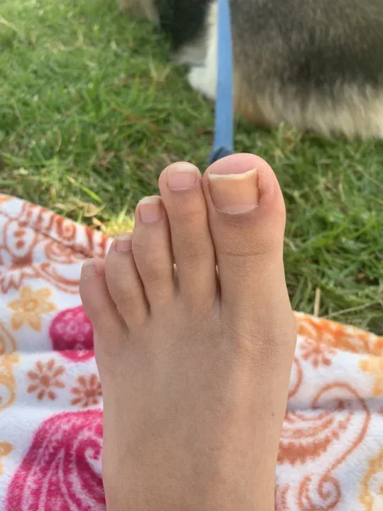 image of Camela Toe